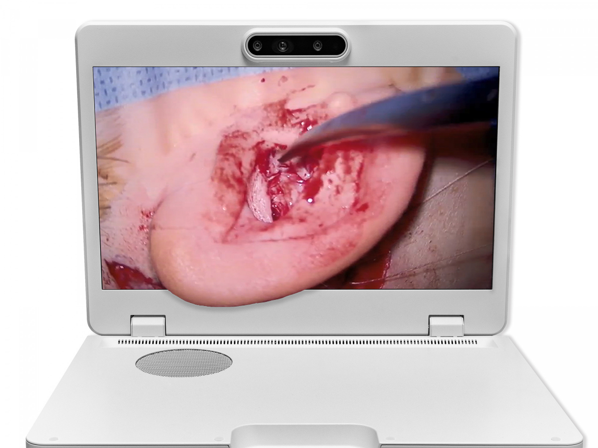 达擎之＂Heads-up 3D显微手术显示系统＂，整合4K裸眼3D显示及眼球追踪系统，具备快速追踪人眼移动位置功能，减轻医师长时间维持固定姿势的负担，让医师能有更宽广清晰的3D立体视野及更舒适的姿势来执行手术。